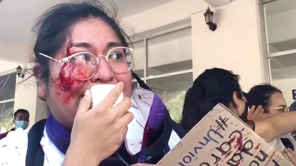 El ataque a Yolitzin es un ataque hacia todas las mujeres Guerrerenses: PRD Guerrero