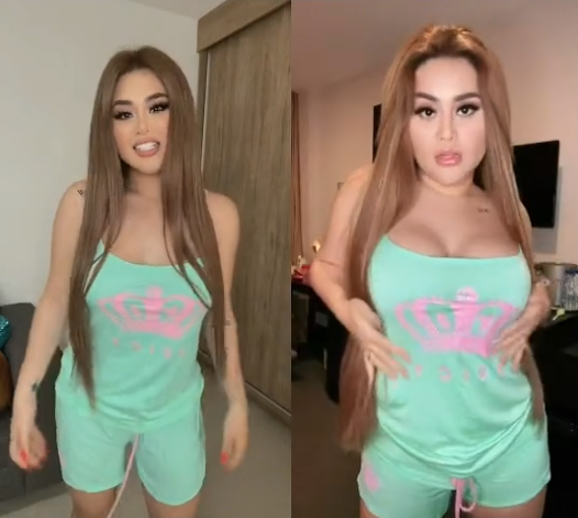 «Gomita» muestra los resultados de su bypass gástrico