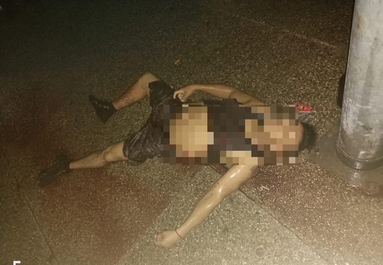 Matan a un hombre en una riña en la avenida Costera en Acapulco