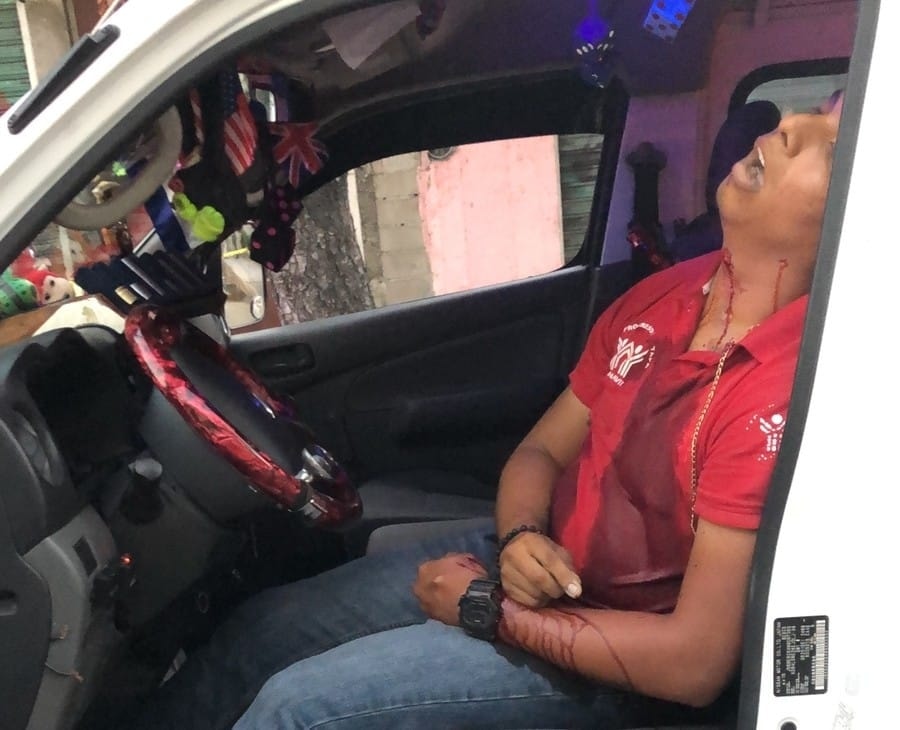 Asesinan a balazos a un chófer de urvan en la avenida Ruiz Cortines en Acapulco