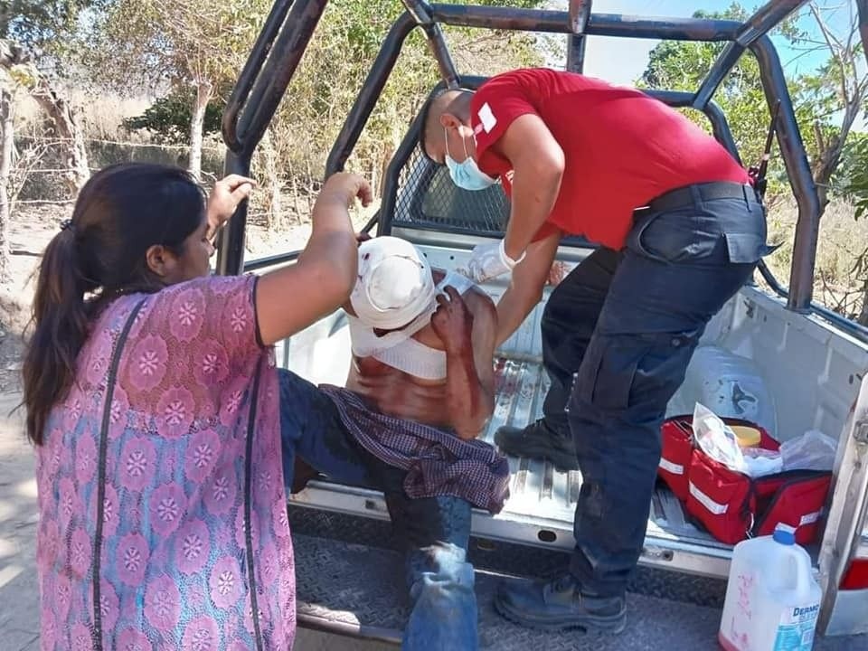 Hombre es herido a machetazos en una localidad de Ometepec, en Guerrero