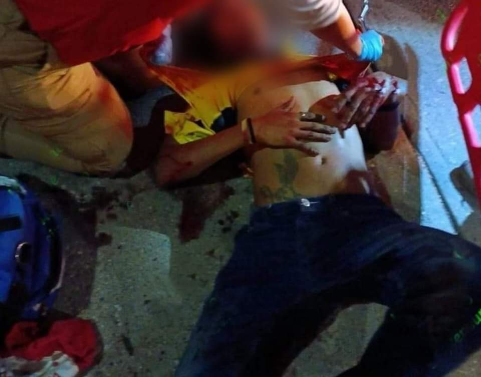 Hombre herido a balazos en el fraccionamiento Condesa de Acapulco