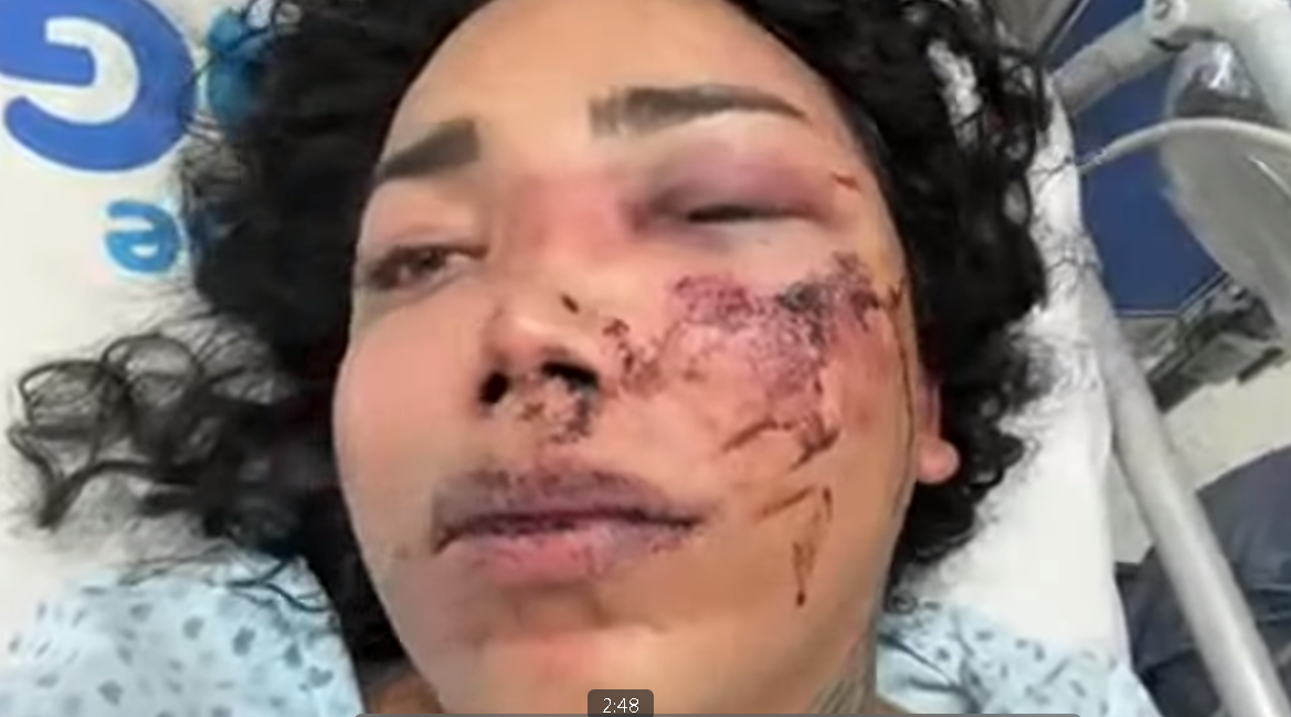 Tras propuesta de matrimonio Paola Suárez hospitalizada por agresión de su pareja