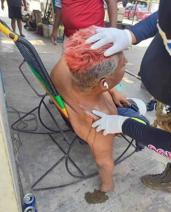 Hombre es asesinado a tiros afuera de su casa en Acapulco